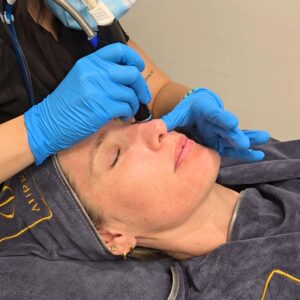 Limpieza Facial Deluxe